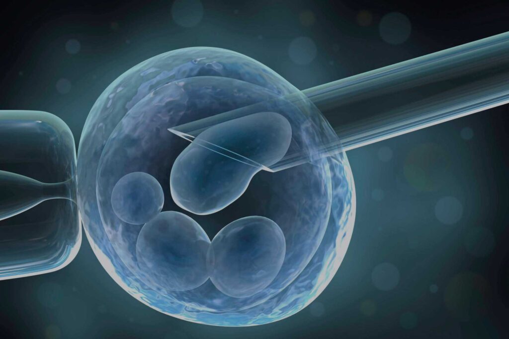 ivf