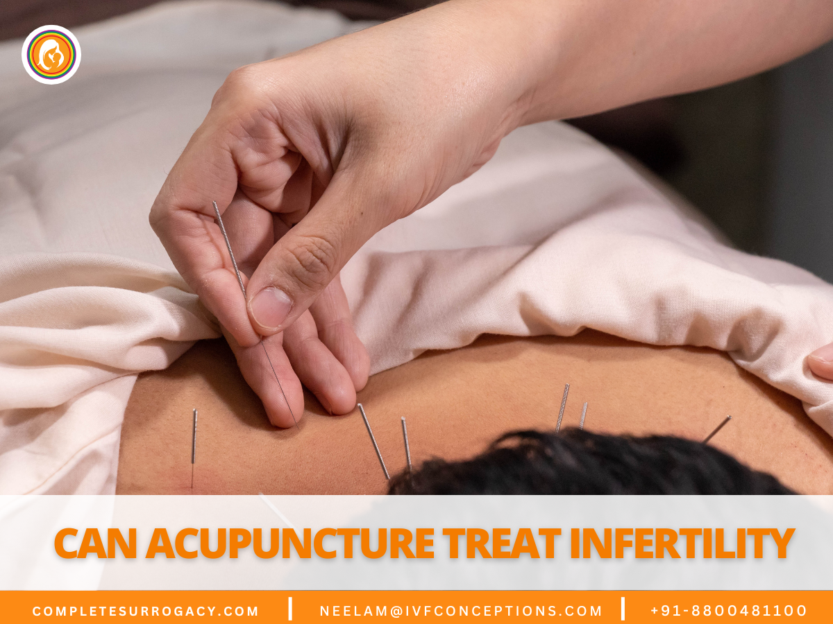 Can Acupuncture Treat Infertility A Comprehensive Guide